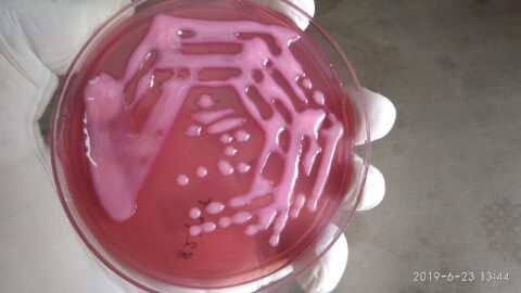 klebsiella pneumoniae