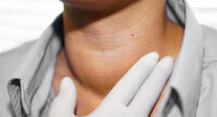 hyperthyroidism