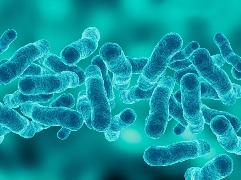 legionella