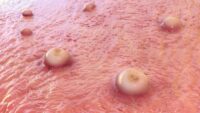 std