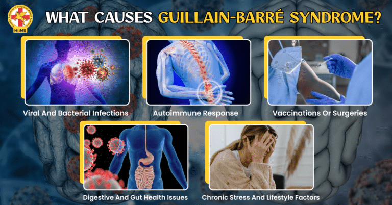 guillain barre syndrome